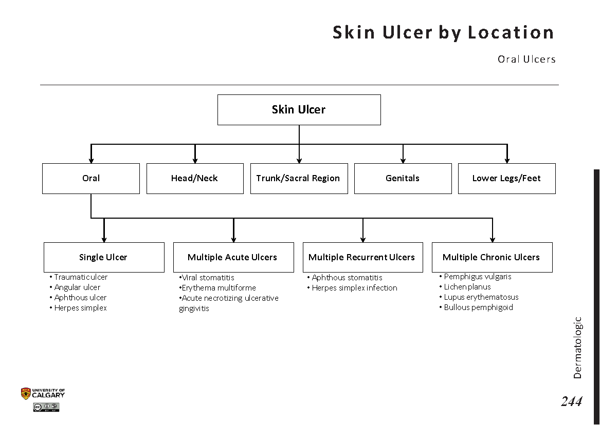 SKIN ULCER BY LOCATION: Oral Ulcers Scheme