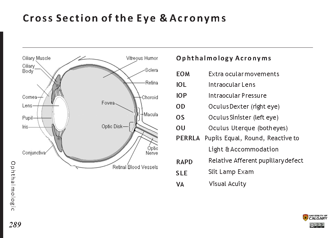 CROSS SECTION OF THE EYE  and ABBREVIATIONS EOM Scheme